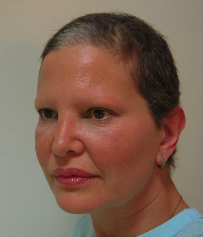 http://i1071.photobucket.com/albums/u503/Robo4747/DSCN3029.jpg