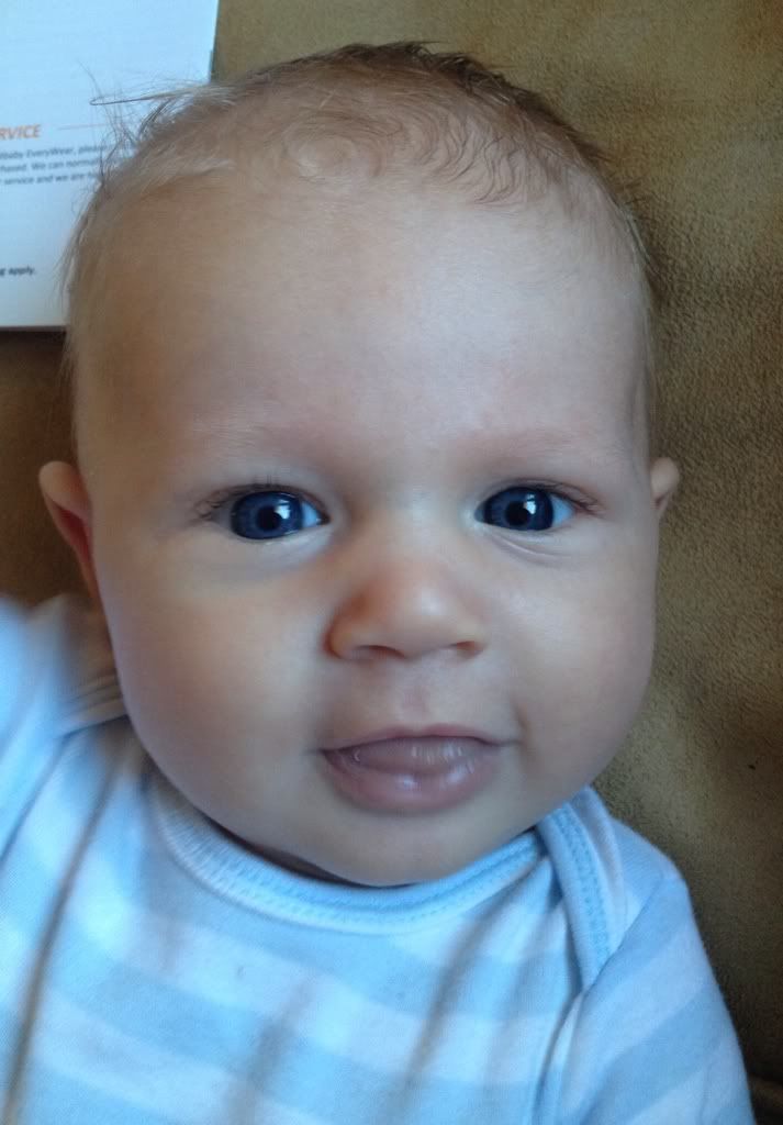Baby with protruding forehead? PIC BabyCenter